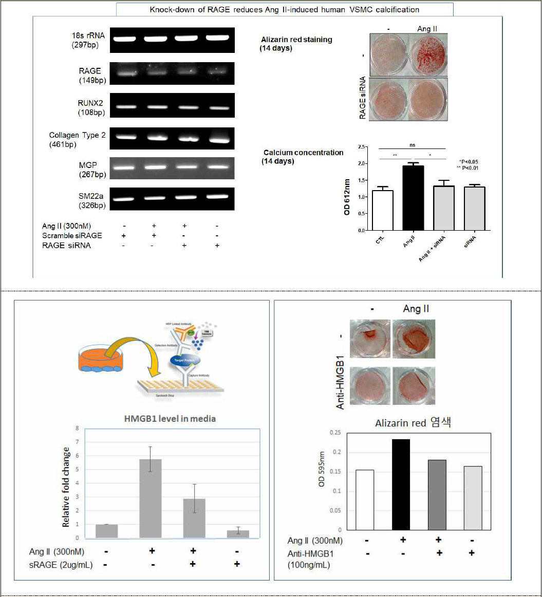 [보고서]불안정성 동맥경화반을 유도하는 미세혈관석회화증에서 RAGE의 조절 기전 및 유용성