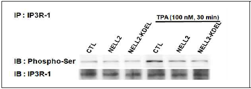 NELL2에 의한 IP3R-1의 인산화 변화. TPA 처리에 의해 IP3R-1의 인산화 (phospho-Ser)가 증가함. 그러나, NELL2 혹은 NELL2-KDEL 과발현 세포에서 TPA에 의해 유도되는 IP3R-1의 인산화는 감소함