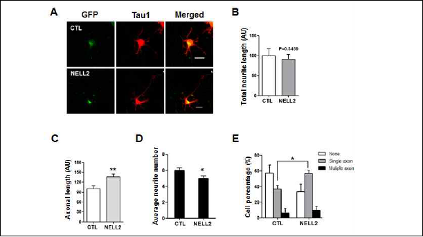 신경세포 발달에 미치는 NELL2의 영향 (A) XB-GFP 또는 NELL2-GFP 과발현 신경세포 (green), Tau-1 (axonal marker,red) (B) 전체 neurite 길이 (C) axon 길이 (D) 평균 neurite 수 (E) axon 개수에 따른 세포 비율