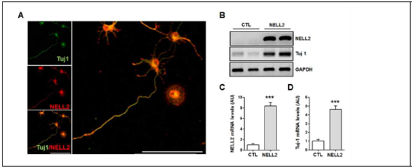 신경 세포주의 분화에 미치는 NELL2의 영향 (A) Tuj-1 (neuron marker, green), NELL2 (red) (B) NELL2 과발현에 따른 Tuj-1 발현증가 (C) NELL2 과발현 정도 (D) Tuj-1 발현 변화 정도