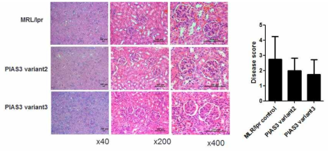 PIAS3에 의한 MRL/lpr Lupus nephritis 분석