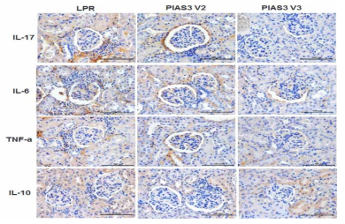 PIAS3에 의한 신장 조직 내 염증성 사이토카인 분석