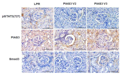 PIAS3에 의한 신장 조직 내 신호 전달 인자 활성 분석