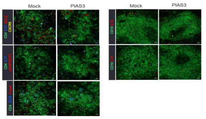 PIAS3에 의한 Roquin 루푸스 비장 조직 내 Tfh 세포 조절및 IL-17 발현 B 세포 조절