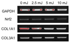 UVB 조사양에 따른 Nrf2 및 collagen의 mRNA 발현양 변화