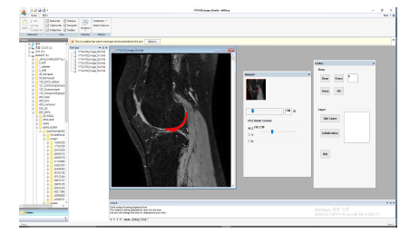 3차원 무릎연골 영상 프로그램의 GUI