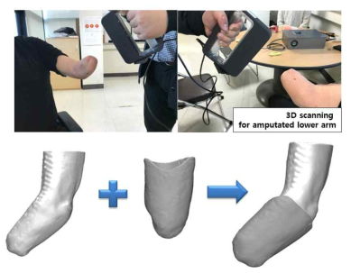 3차원 스캐너를 통한 상지절단자 단단부 형상 확보: 상지절단 단단부 촬영(위), 3차원 단단부-소켓 결합모델 형상(아래)