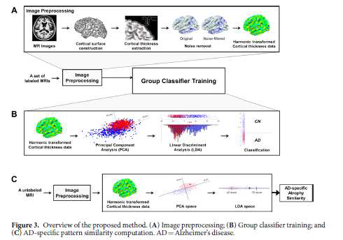 치매환자의 뇌위축 패턴을 분석하고 분류하는 알고리즘