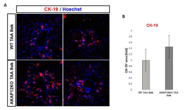 TAA에 의한 WT과 AKAP12 KO 마우스의 cholangiocyte 증식 비교