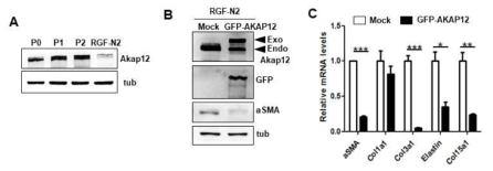 AKAP12 과발현에 의한 portal fibroblast 세포주의 활성화 억제