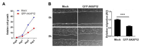 AKAP12 과발현에 의한 RGF-N2 세포의 세포증식 및 세포이동성 감소