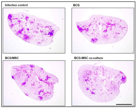 마우스 결핵감염모델에서 vaccination한 후 폐의 병변 분석