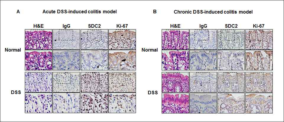 급성과 만성으로 유도된 대장 염증 마우스 모델을 이용한 면역염색. 급성(A) 혹은 만성(B)으로 유도된 대장 염증 마우스 모델의 대장 조직을 H&E 염색 및 anti-SDC-2 항체와 anti-Ki-67 항체를 이용한 면역조직염색하여 단백질의 발현 정도를 비교 분석 함