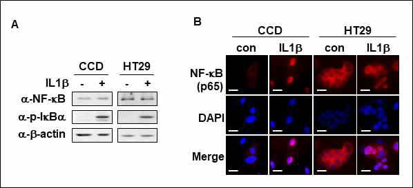 염증성사이토카인에 의한 SDC-2 발현변화 및 조절 기전. (A) CCD841CoN과 HT29 세포주에 IL1β를 처리하고 NFκB와 p-IκBα의 단백질 레벨을 western blot으로 확인하였음. (B) IL1β를 처리한 뒤, NFκB(p65)의 nuclear translocalization을 형광현미경으로 확인하였음