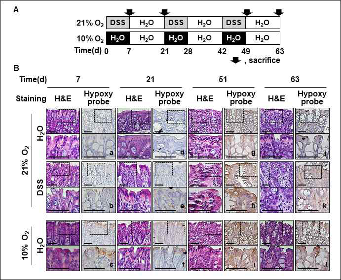 만성염증에 의한 대장상피 조직의 저산소증 유도 (A) DSS와 저산소에 의한 염증 유도 모델 실험 일정. (B) 모델동물 마우스에 Hypoxyprobe-1 용액을 infusion하고 대장조직을 H&E 염색 또는 pimonidazole을 인지하는 마우스 IgG1 항체로 면역염색하였음. 100X 배율 (위)과 200X 배율 (아래). Scale bars: 50 μm