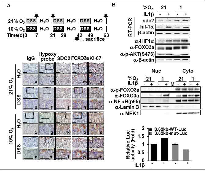만성염증과 저산소증에 의한 상보적 SDC-2 발현 조절 (A) 21% 산소와 10% 산소 하에서 DSS 염증 모델을 유도하였음. 모델동물 마우스에 Hypoxyprobe-1 용액을 infusion하고 대장조직을 pimonidazole을 인지하는 마우스 IgG1 항체 또는 해당 항체로 면역염색하였음. 100X 배율 (위)과 200X 배율 (아래). Scale bars: 50 μ m. (B) 대장암세포를 21% 산소와 1% 산소 하에서 배양하고 IL1β를 처리하였음. 단백질의 발현양은 western blot으로, mRNA 발현양은 RT-PCR로 분석하였음. SDC-2 전사활성은 reporter assay로 수행하였음