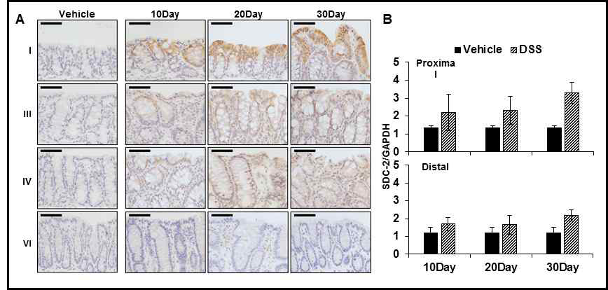 만성대장염증 동물 모델에서의 SDC-2 발현 (A) 대장의 proximal (I), transverse (III, IV), distal (VI) 부위에서의 SDC-2 발현을 면역조직화학법으로 확인함. Scale bar = 50μm (B) 대장의 proximal 과 distal 부위에서의 syndecan-2 유전자의 레벨을 qRT-PCR로 확인함