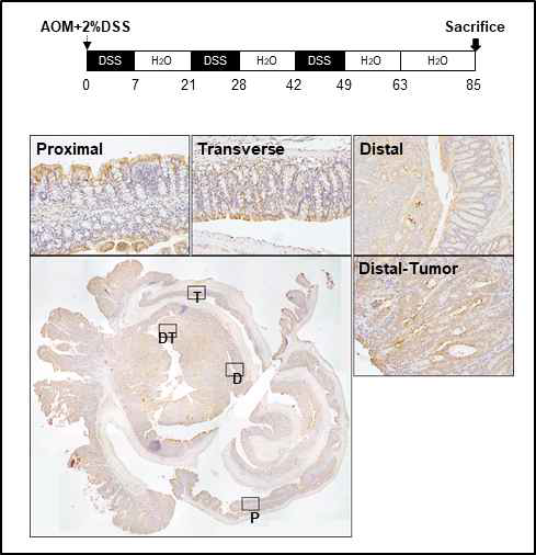 AOM-DSS 발암유도 동물모델 조직에서 SDC-2 발현 조사. 실험시작 시점에 C57/BL6 마우스에 AOM을 한번 피하주사하고, 2% DSS를 식수에 섞어 7일간 마시게 하였으며, 이후 일반 식수로 교체하여 2주간의 회복기간을 주었음. 이 반복을 3번 반복한 후 실험시작 후 84일에 동물을 희생시키고 대장을 적출하고, 대장암발생부위 (Distal-tumor)와 정상 부위 (proximal, transverse, distal) 조직에서 SDC-2 발현을 면역염색 하였음