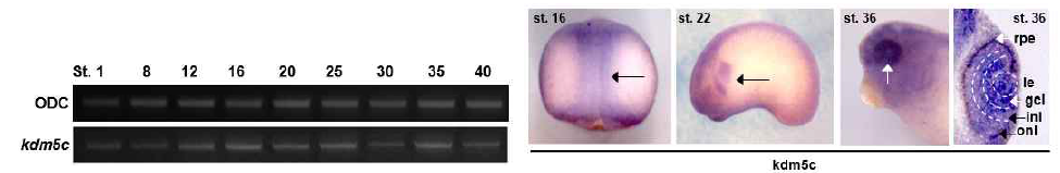 Kdm5c의 시공간적 발현 양상