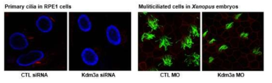 Kdm3A 발현저하로 척추동물의 섬모 형성에 나타난 이상표현형