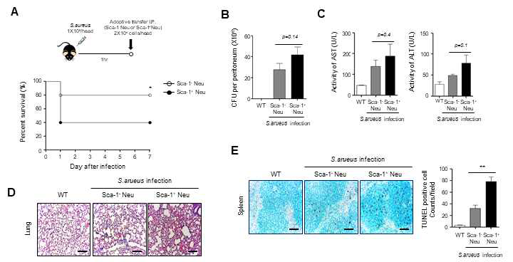 S. aureus 감염 모델에서 Sca-1- 호중구 및 Sca-1+ 호중구의 adoptive transfer에 의한 패혈증 병리 조절