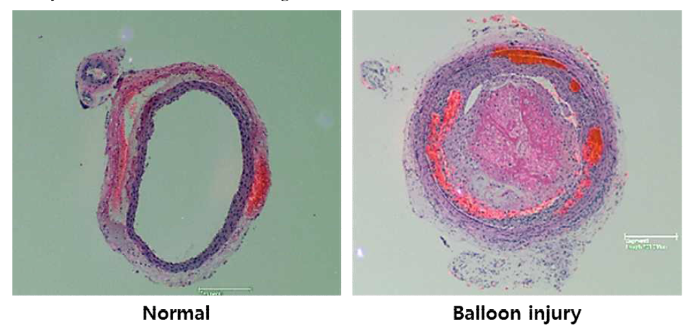 정상혈관과 손상혈관의 비교분석