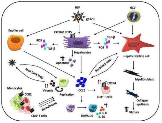 간섬유화에서의 CCL2의 역할(Ansari 등, 2014)