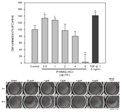 Gel contraction 평가