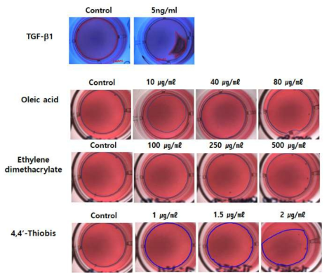 Gel contraction 평가