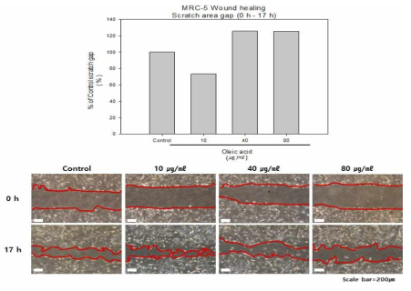 Wound healing assay를 통한 세포이동성 평가 (oleic acid)