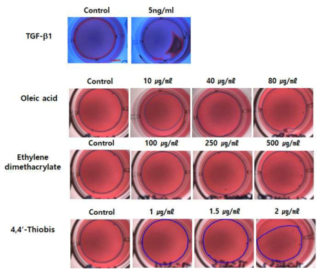 Gel contraction 평가