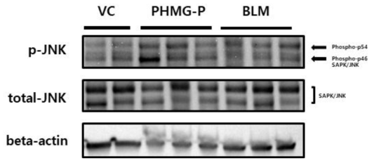 폐섬유화 유발물질 투여에 의한 JNK 활성 및 발현 분석 결과(단백질)