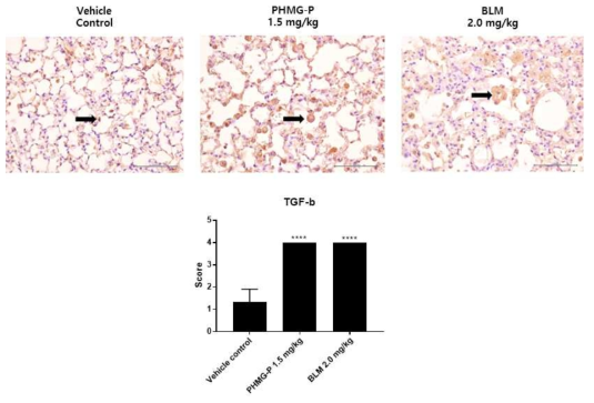 폐섬유화 유발물질 투여에 의한 TGF-b 발현분석 결과(단백질)