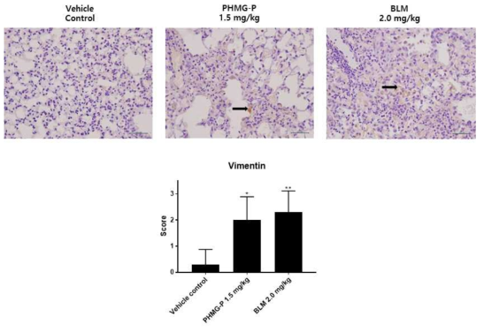 폐섬유화 유발물질 투여에 의한 vimentin 발현분석 결과(단백질)
