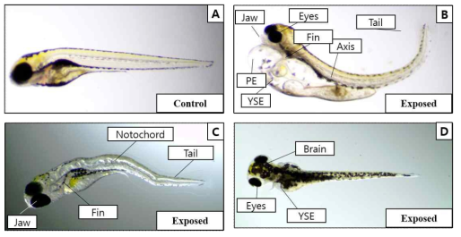 정상인 5 dpf 치어 사진 (A), yolk sac edema, pericardial edema, axis, somite, tail, notochord, jaw, fin, trunk, eyes, swim bladder 등 11가지 기형에 대한 대표 사진 (B, C, D)