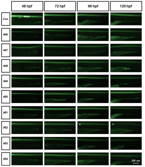 tg (elavl3:eGFP)를 활용한 단일물질 신경독성평가 (Axon width)