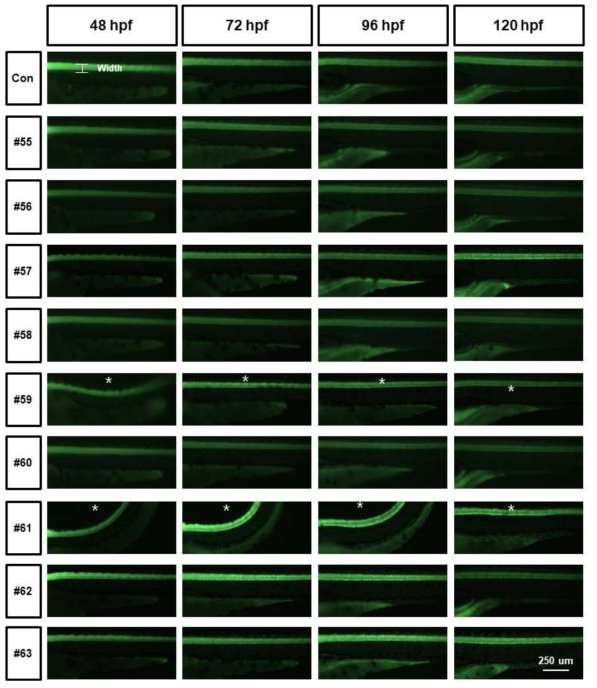 tg (elavl3:eGFP)를 활용한 단일물질 신경독성평가 (Axon width)