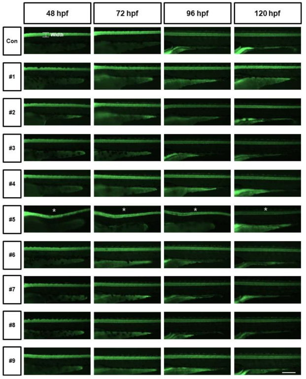 tg (elavl3:eGFP)를 활용한 복합물질 신경독성평가 (Axon width)