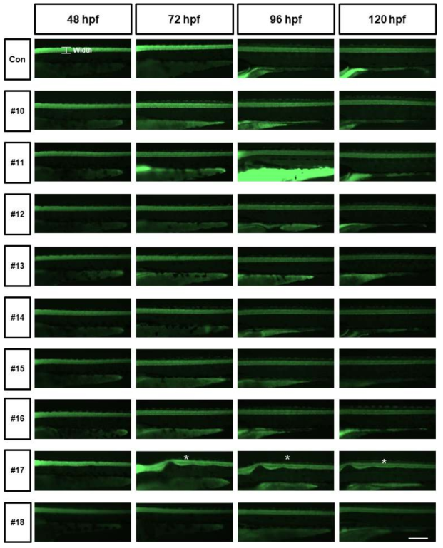 tg (elavl3:eGFP)를 활용한 복합물질 신경독성평가 (Axon width)