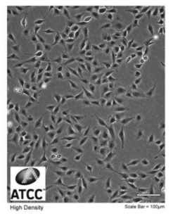 Beas-2B 세포 (출처:https://www.atcc.org/Products/All/CRL-9609.aspx#characteristics)