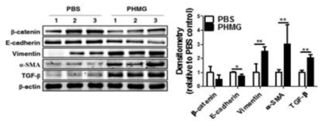 PHMG-P에 의한 폐질환 영향 KE(단백질) 측정 결과