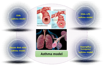 Asthma model