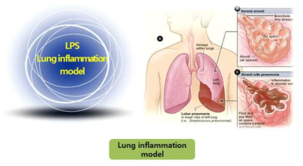 Lung inflammation model