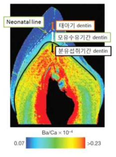 LA-ICP MS를 이용하여 획득한 유치상 Ba/Ca 레벨 이미지