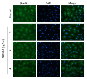 NHBE에서 PHMG-P의 처리 농도별 beta-actin에 대한 영향 조사