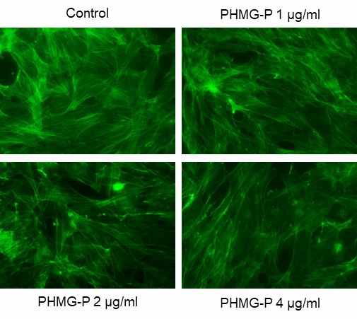BEAS-2B에서 PHMG-P의 농도별 F-actin에 대한 영향조사