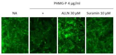 BEAS-2B에서 PHMG-P로 유도된 F-actin 변형에 대한 Calpain 및 P2R 억제제의 영향조사