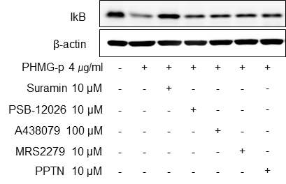 BEAS-2B에서 PHMG-P로 유도된 IkB 분해에 대한 P2R 억제제의 영향조사
