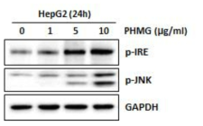 PHMG-P에 의한 p-IRE, p-JNK 단백질 발현 변화