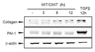 CMIT/MIT의 섬유화 유전자 발현 평가